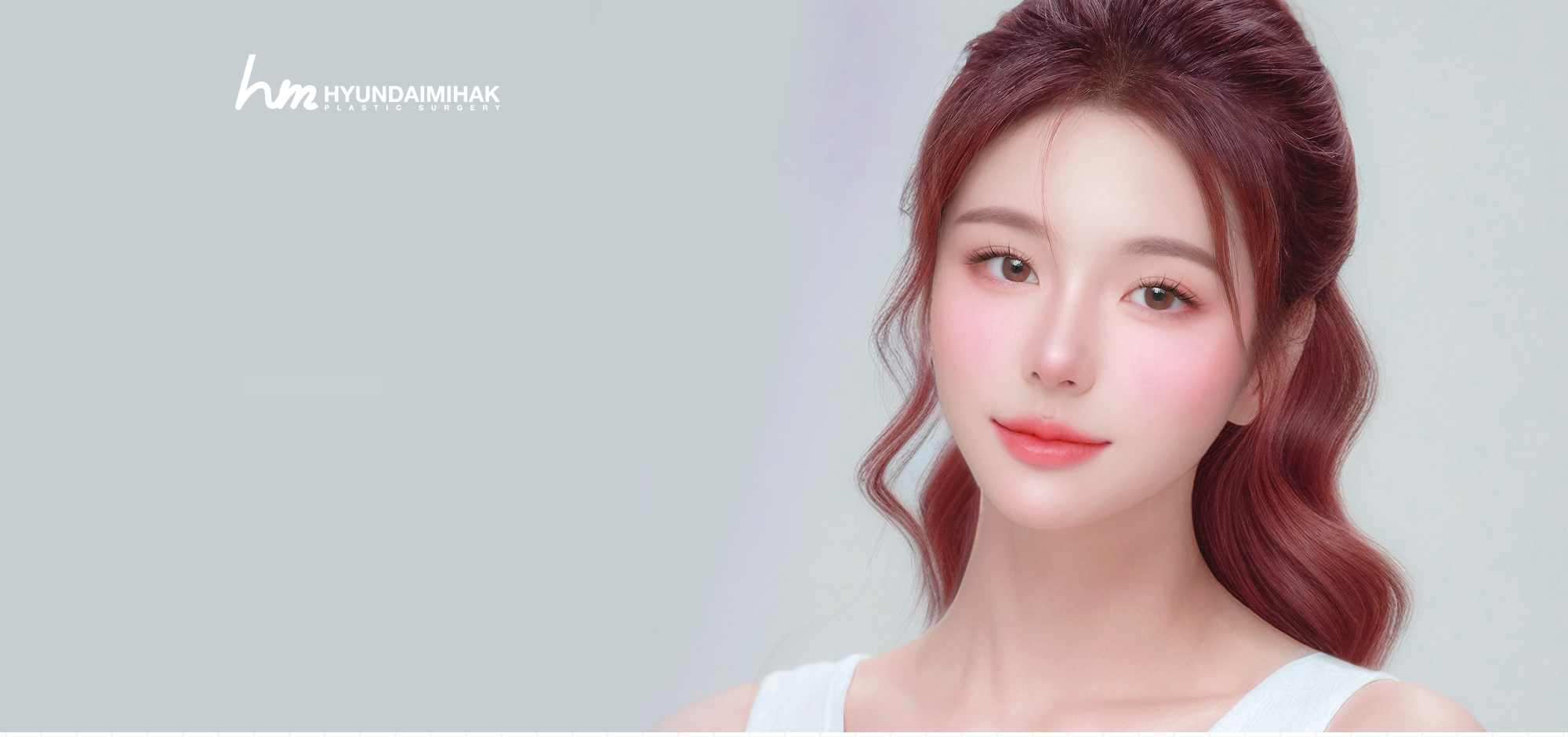 Нитевой лифтинг Mill от Hyundai Aesthetics — коррекция провисшей кожи и второго подбородка