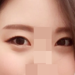 Perfect Big Eye плюс дополнительная кантопластика!