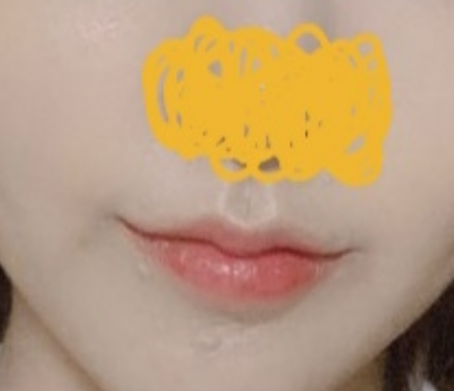 Операция на уголках губ удалась >_<