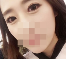 Highly recommend Гёндэ Михак eye-shape correction!~♥