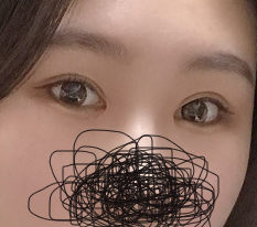 They really deserve the nickname canthoplasty specialist~ Гёндэ Михак is the best!