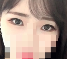 Totally satisfied with Гёндэ Михак eye-shape correction♥
