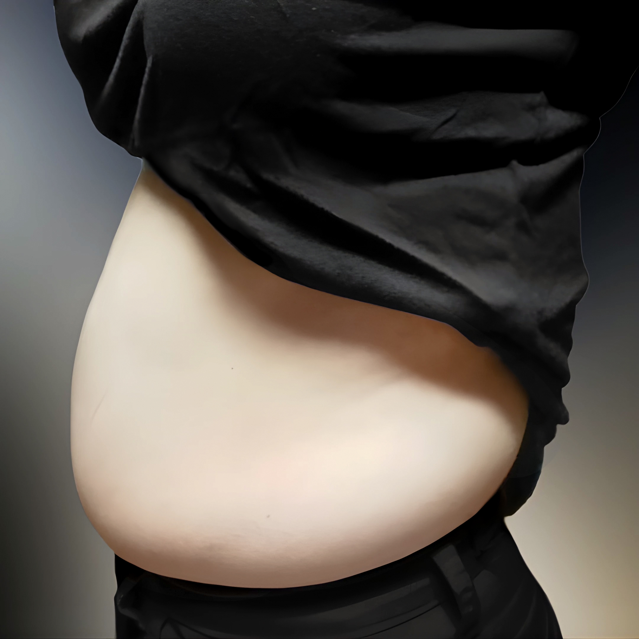Срезала жир на животе #lovehandles #бока #задниебока #живот