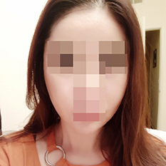 Уменьшение скул — это что-то невероятное ㅎㅎ