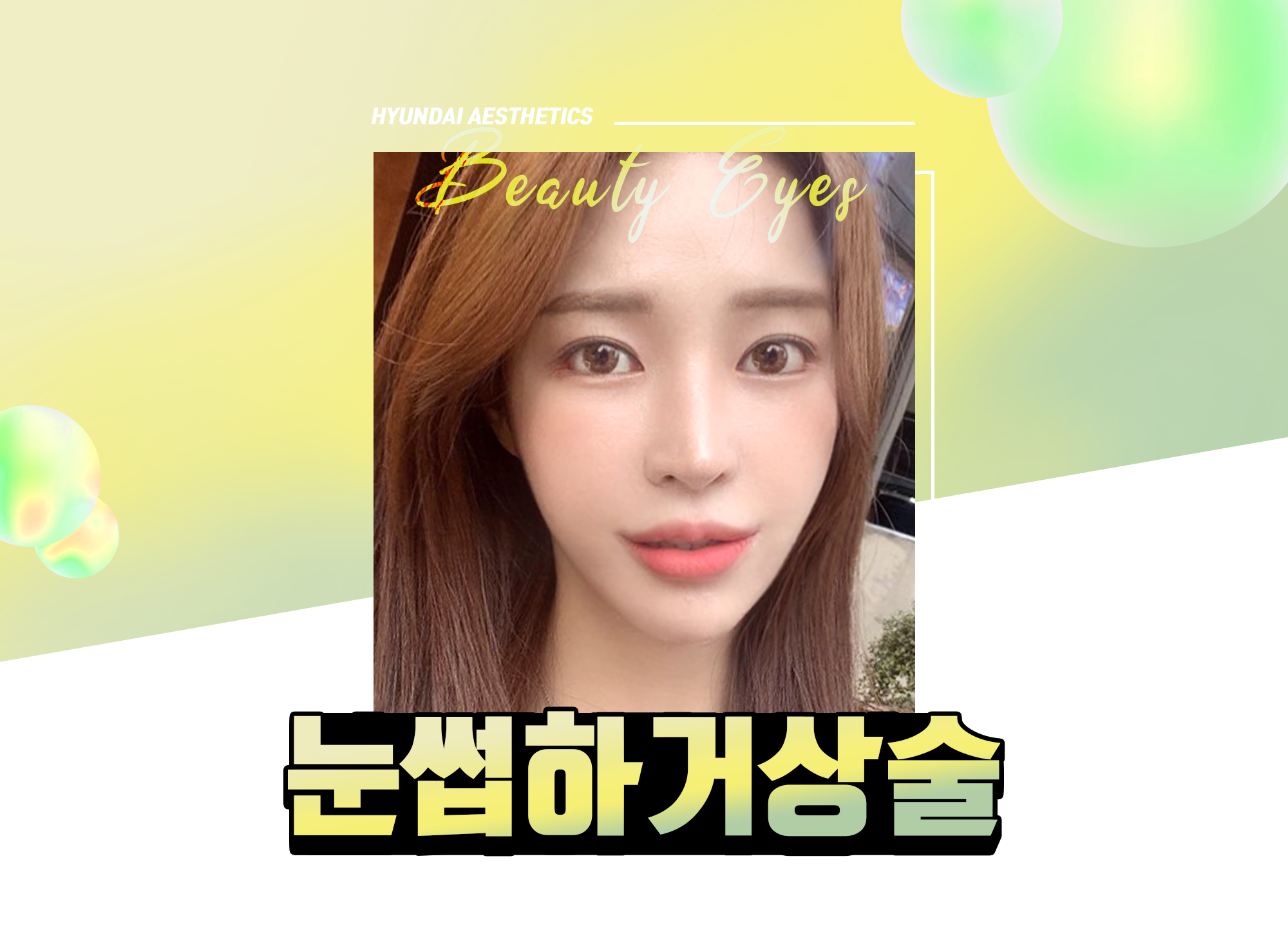 Hyundai Aesthetics подтяжка бровей — HYUNDAI AESTHETICS Beauty Eyes, фото модели для нижней подтяжки бровей