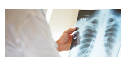 X-Ray обследование