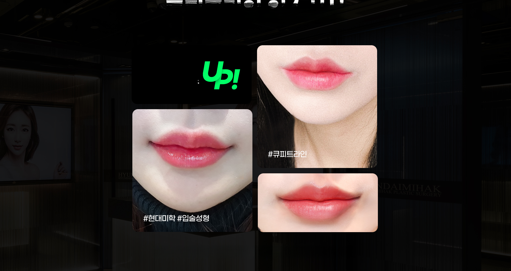 Фото губ до и после пластики губ Cupid Line